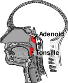 Schema Tonsillen