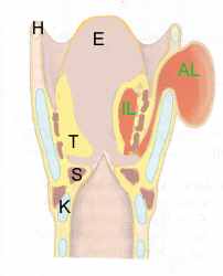 Schema Laryngozele