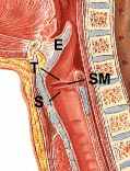 Sinus morgagni