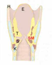 Sinus morgagni