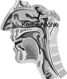 Sphenoid